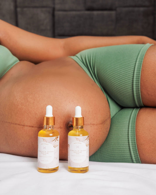 Stretchmark Repair Oil